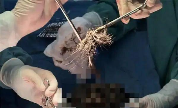 九游体育app官网身高 1.6 米的妮妮体重仅 35 公斤-Ninegame-九游体育(中国)官方网站|jiuyou.com